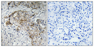 Immunohistochemistry validation of SCNN1B using Anti-Phospho-ENaC beta (T615) SCNN1B Antibody (A01670T615)