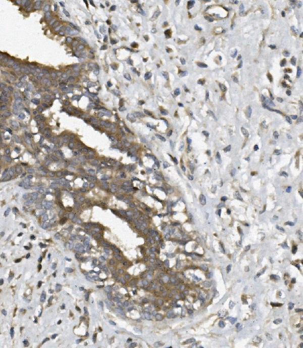 a01672 2 ung primary antibodies ihc testing 2