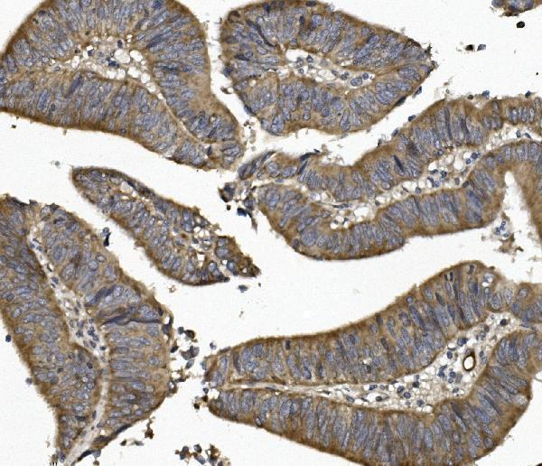 a01672 2 ung primary antibodies ihc testing 3
