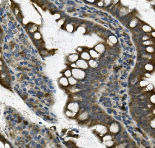 a01672 2 ung primary antibodies ihc testing 4