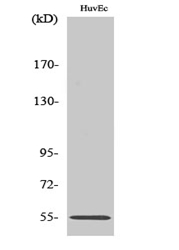 Western blot analysis of various cells using c-Fgr Polyclonal Antibody