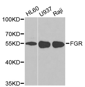 a01674 fgr primary antiboties wb testing 1