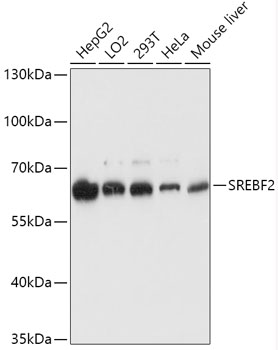a01678 1 srebf2 primary antiboties wb testing 1
