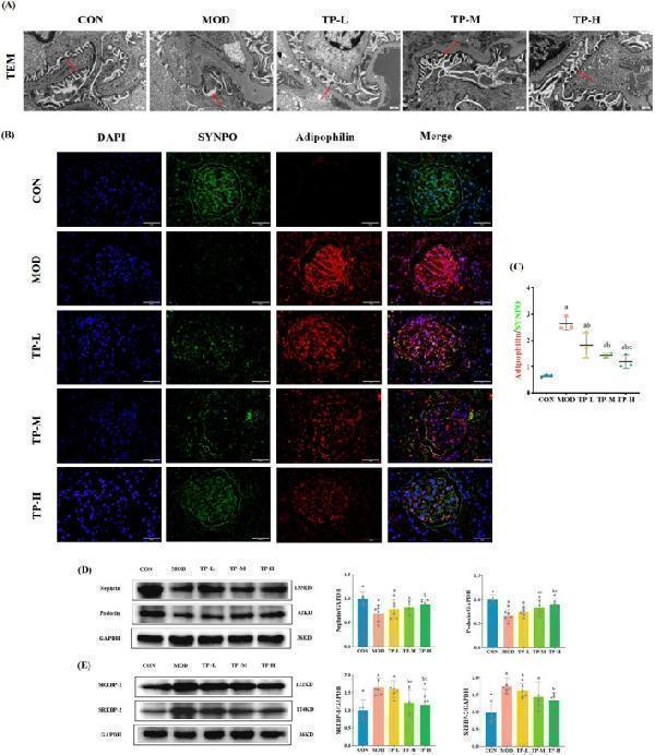 TP improved podocyte lipid accumulation and injury in the aging with DKD model rats