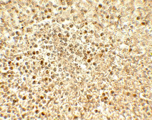 a01678 srebf2 primary antibodies ihc testing 2