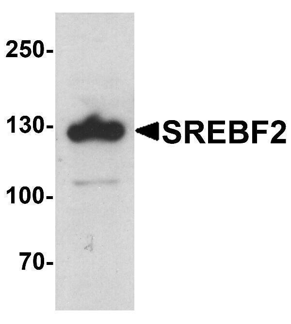 a01678 srebf2 primary antibodies wb testing 1