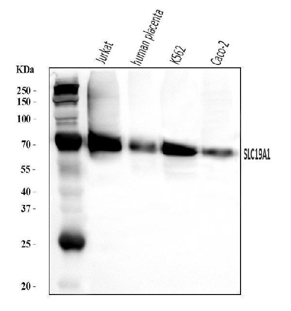  Western blot analysis of RFC/SLC19A1 using anti-RFC/SLC19A1 antibody (A01679-1)