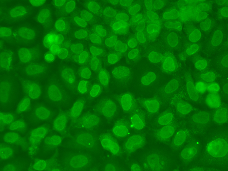 a01680 1 tarbp2 primary antiboties if testing 4