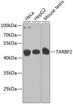 Western blot analysis of extracts of various cell lines, using TARBP2 antibody  at 1:1000 dilution