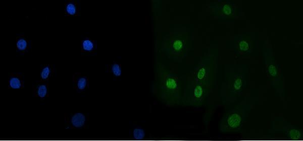 a01680 2 tarbp2 primary antibodies if testing 6