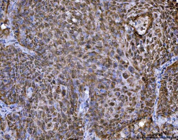  IHC analysis of TRBP/TARBP2 using anti-TRBP/TARBP2 antibody (A01680-2)