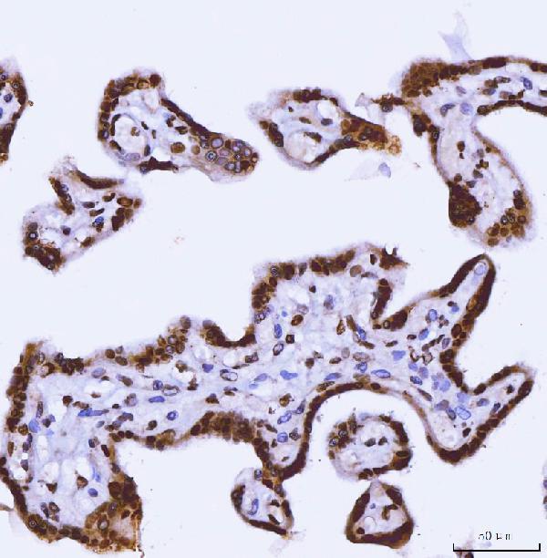  IHC analysis of TRBP/TARBP2 using anti-TRBP/TARBP2 antibody (A01680-2)
