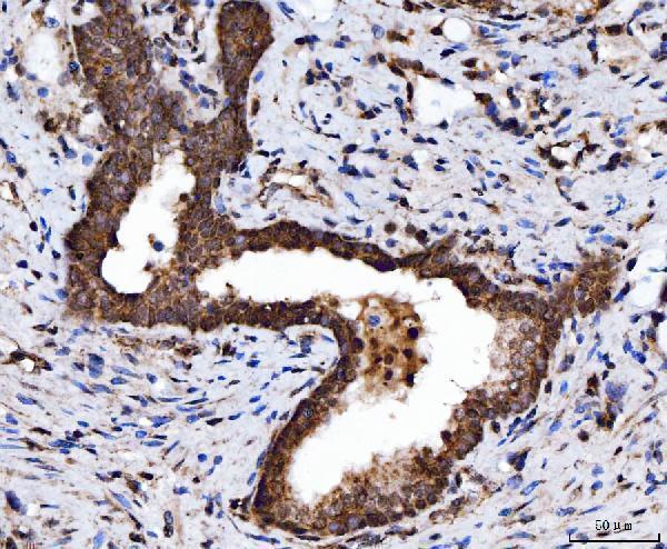 a01680 2 tarbp2 primary antibodies ihc testing 4