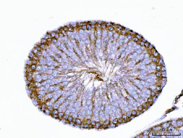a01680 2 tarbp2 primary antibodies ihc testing 5