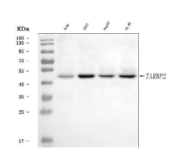  Western blot analysis of TRBP/TARBP2 using anti-TRBP/TARBP2 antibody (A01680-2)
