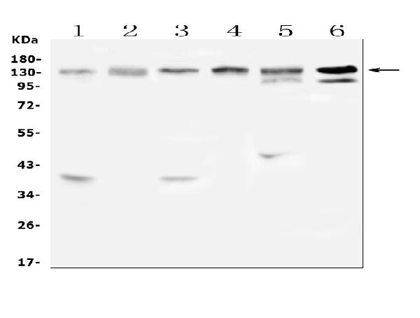 Western blot analysis of EPS15 using anti-EPS15 antibody (A01681). Electrophoresis was performed on a 5-20% SDS-PAGE gel at 70V (Stacking gel) / 90V (Resolving gel) for 2-3 hours. The sample well of each lane was loaded with 50ug of sample under reducing conditions. Lane 1: rat brain tissue lysates, Lane 2: rat liver tissue lysates, Lane 3: mouse brain tissue lysates, Lane 4: mouse spleen tissue lysates, Lane 5: mouse liver tissue lysates, Lane 6: mouse testis tissue lysates. After Electrophoresis, proteins were transferred to a Nitrocellulose membrane at 150mA for 50-90 minutes. Blocked the membrane with 5% Non-fat Milk/ TBS for 1.5 hour at RT. The membrane was incubated with rabbit anti-EPS15 antigen affinity purified polyclonal antibody (Catalog # A01681) at 0.5 μg/mL overnight at 4°C, then washed with TBS-0.1%Tween 3 times with 5 minutes each and probed with a goat anti-rabbit IgG-HRP secondary antibody at a dilution of 1:10000 for 1.5 hour at RT. The signal is developed using an Enhanced Chemiluminescent detection (ECL) kit (Catalog # EK1002) with Tanon 5200 system. A specific band was detected for EPS15 at approximately 140KD. The expected band size for EPS15 is at 99KD.