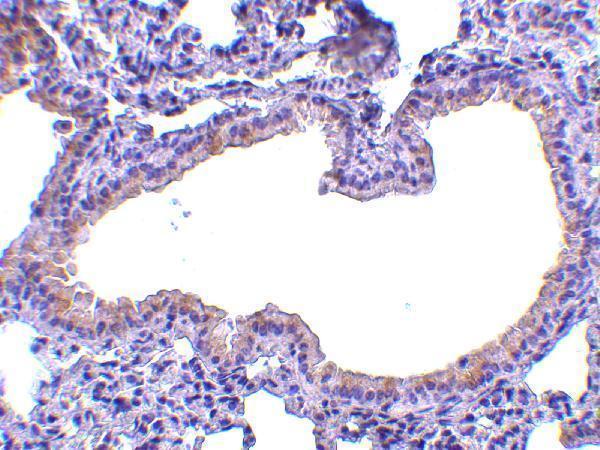 a01682 slpi primary antibodies ihc testing 2