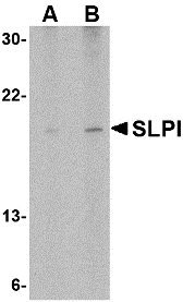a01682 slpi primary antibodies wb testing 1