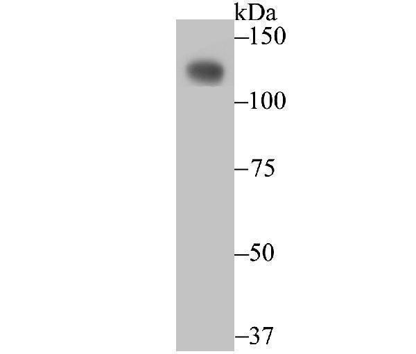 Western blot analysis of CD146 on SiHa cell using anti-CD146 antibody at 1/500 dilution