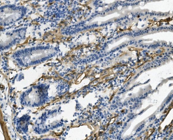  IHC analysis of MCAM using anti-MCAM antibody (A01683)