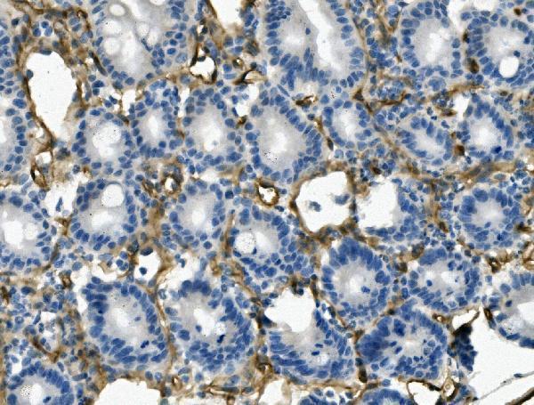  IHC analysis of MCAM using anti-MCAM antibody (A01683)