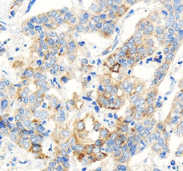 IHC analysis of OAS1/3 using anti-OAS1/3 antibody (A01684-3)