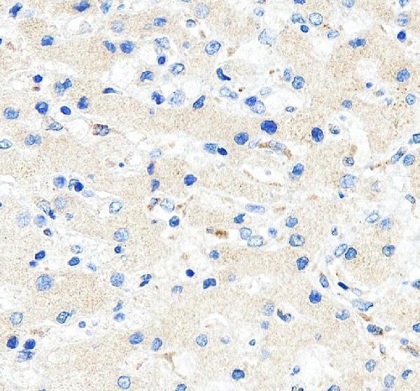 IHC analysis of OAS1/3 using anti-OAS1/3 antibody (A01684-3)