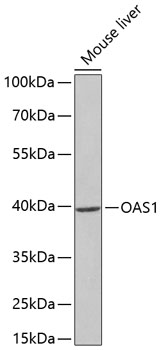 Western blot analysis of extracts of mouse liver cells, using OAS1 antibody