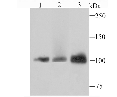 Western blot analysis of DNA Ligase IV on Hela cell using anti-DNA Ligase IV antibody at 1/1,000 dilution
