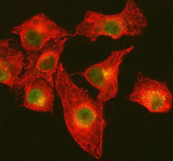  IF analysis of DNA Ligase IV/LIG4 using anti-DNA Ligase IV/LIG4 antibody (A01685-3) and anti-Tubulin Alpha antibody (M03989-3)