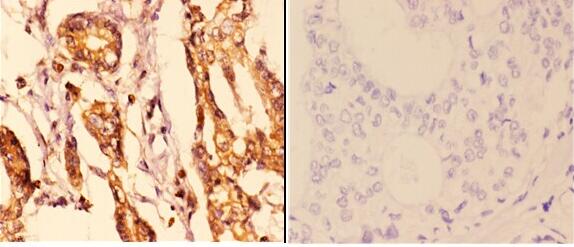 a01687 2 ywhae primary antiboties ihc testing 2