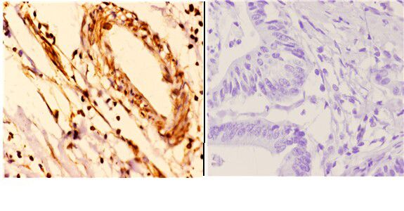 a01687 2 ywhae primary antiboties ihc testing 3