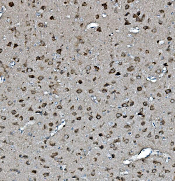 a01687 4 ywhae primary antibodies ihc testing 2