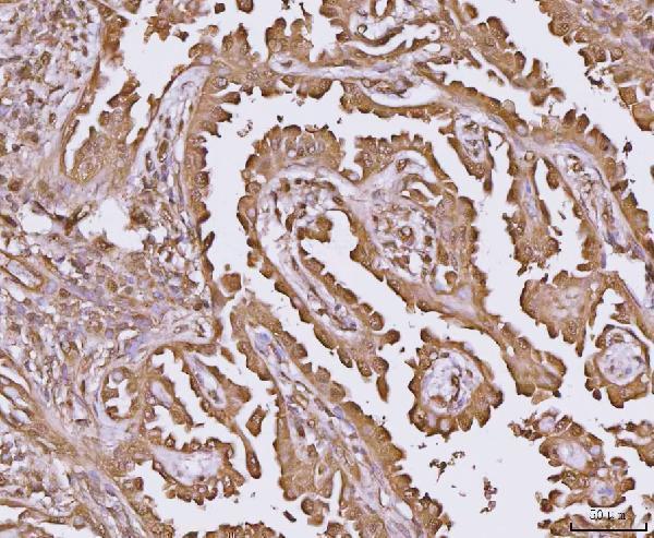 a01687 5 ywhae primary antibodies ihc testing 2