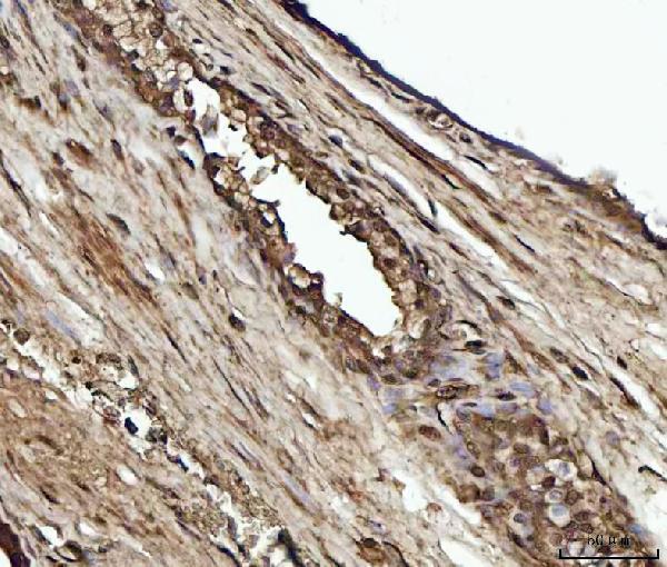a01687 5 ywhae primary antibodies ihc testing 3