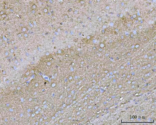 a01687 5 ywhae primary antibodies ihc testing 4