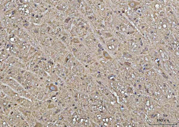 a01687 5 ywhae primary antibodies ihc testing 5