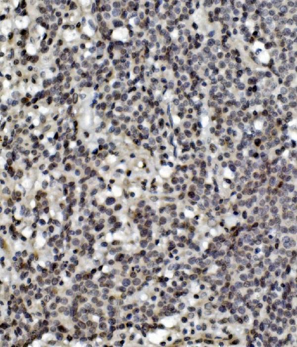 IHC analysis of MCPIP1/ZC3H12A using anti-MCPIP1/ZC3H12A antibody (A01688-2)