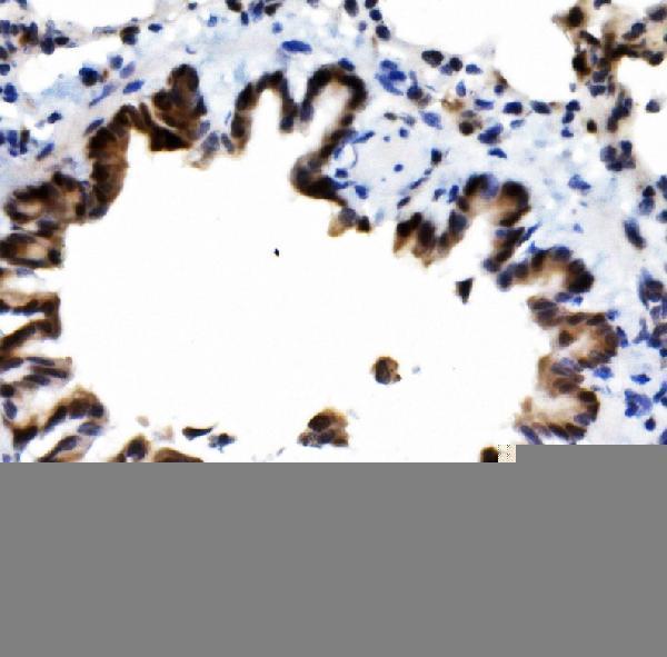  IHC analysis of MCPIP1/ZC3H12A using anti-MCPIP1/ZC3H12A antibody (A01688-2)