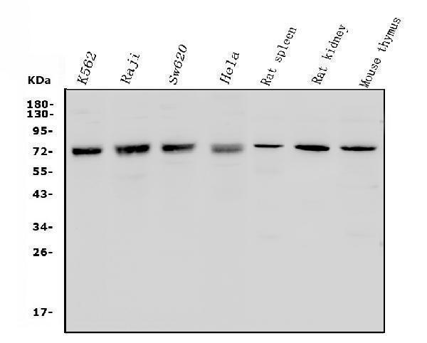  Western blot analysis of MCPIP1/ZC3H12A using anti-MCPIP1/ZC3H12A antibody (A01688-2)