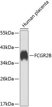 Western blot analysis of extracts of human placenta, using FCGR2B antibody  at 1:1000 dilution