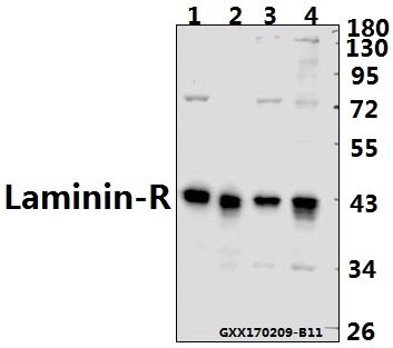 Western blot (WB) analysis of Laminin-R (Q215) polyclonal antibody at 1:500 dilution
Lane1:CT26 whole cell lysate(40ug)
Lane2:PC12 whole cell lysate(40ug)
Lane3:A549 whole cell lysate(40ug)
Lane4:HEK293T whole cell lysate(40ug)