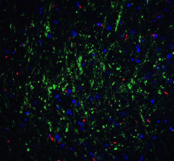 a01691 rpsa primary antibodies if testing 5