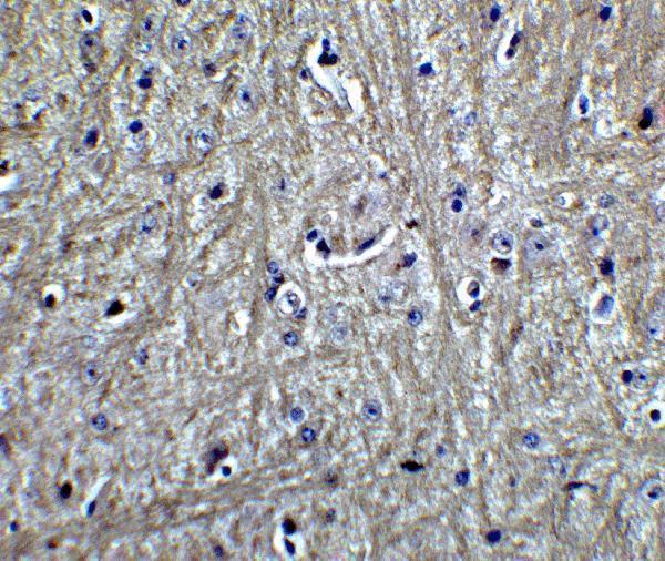 a01691 rpsa primary antibodies ihc testing 4