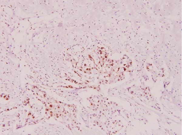 a01692s254 hsp90ab1 primary antiboties ihc testing 2