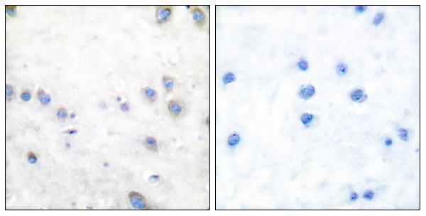 a01696t290 1 map3k8 primary antibodies ihc testing 5