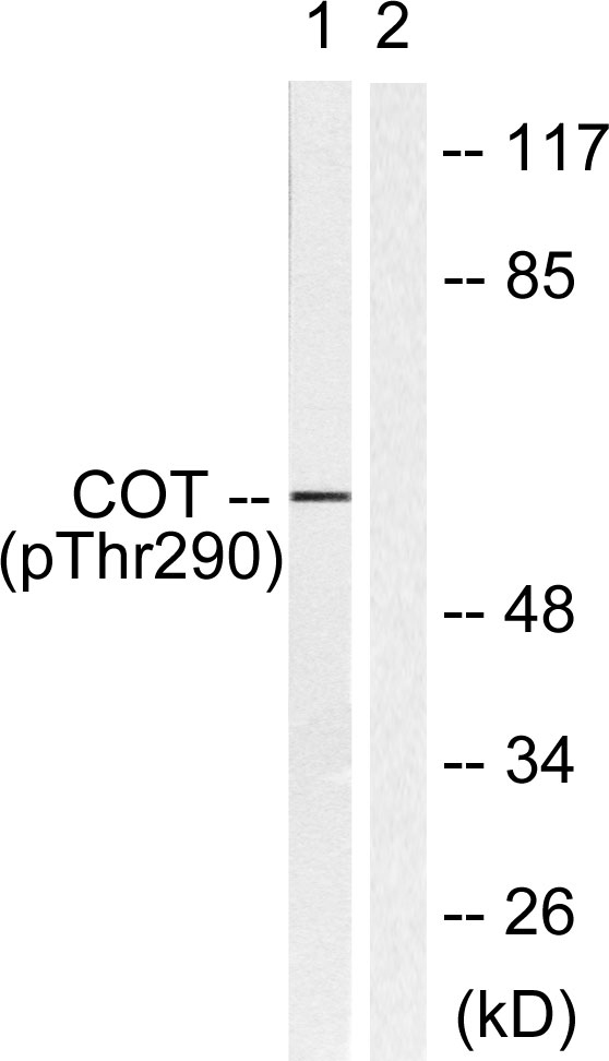 Western blot analysis of lysates from 293 cells treated with UV 15