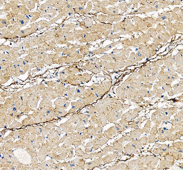 IHC analysis of DDR2 using anti-DDR2 antibody (A01698-1)