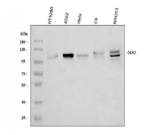  Western blot analysis of DDR2 using anti-DDR2 antibody (A01698-1)