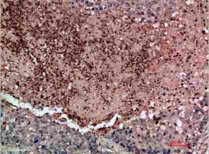 a01698 ddr2 primary antibodyes ihc testing 1